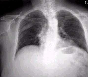 Descrierea radiografiei, referință