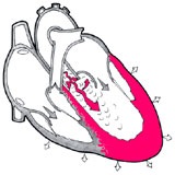 Open duct arterial la copii - cauze, simptome, decât periculoase, tratament