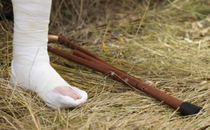 Törés a calcaneus kezelt, a tünetek és az elsősegély