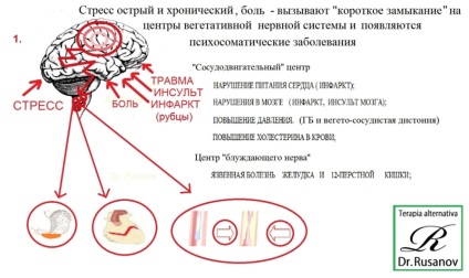 Персональний сайт - нервове збудження, перенапруження