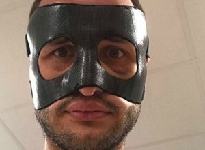 De ce joacă fotbalistul Fedor Kudryashov în mască