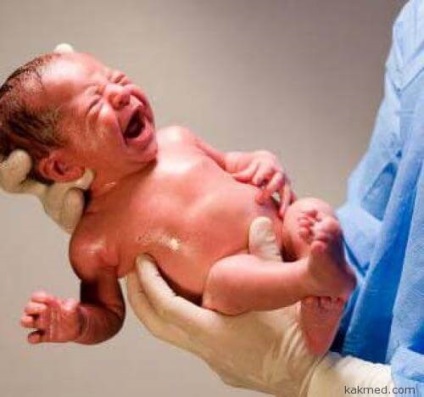 De ce, după naștere, plămânii copilului nu s-au deschis