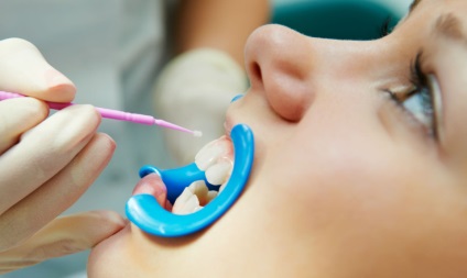 Curatarea igienica a dintilor profesionisti pentru copiii din stomatologie, frumoasa