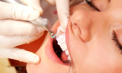 Curatarea igienica a dintilor profesionisti pentru copiii din stomatologie, frumoasa