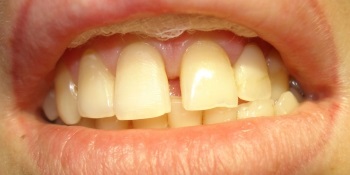 Restaurare dinti ufa comentarii, preturi, adresele stomatologice