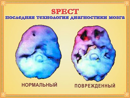 Meditația vă va ajuta să ieșiți din depresie