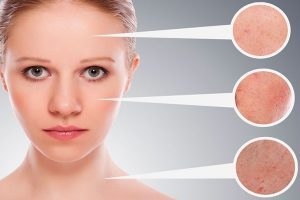 Seborrhoeás dermatitis az arcon az okok előfordulásának és a kezelés