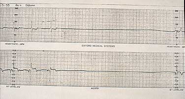 Resuscitarea cardiopulmonară în stadiul pre-spital, # 12