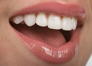 Metode moderne de restaurare a smalțului dinților, o analiză a metodelor și mijloacelor