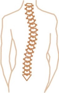 Grade de scolioză, tratament corect