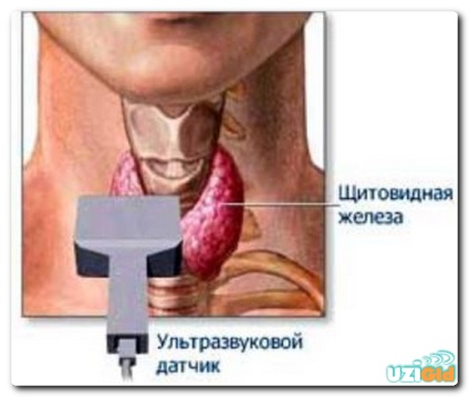 Glanda tiroidă care arată decodificarea