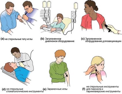 Știi cum să nu te infectezi cu hepatita și să-ți protejezi rudele