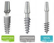 Implantarea bazală, implantarea directă, implantarea dinților, cum se fac dinții