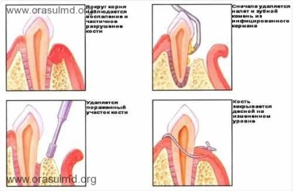 Ce trebuie să faceți dacă un copil are un site web pentru gingii pentru sfaturi utile