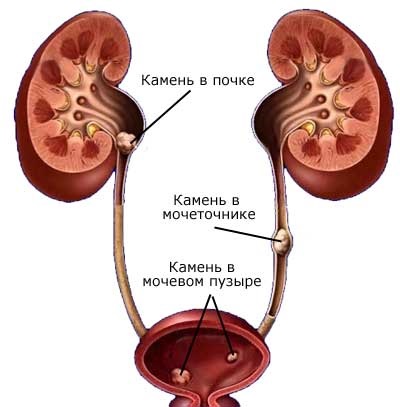 Ceea ce poate fi văzut cu uzi din vezică