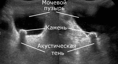 Mi látható az ultrahangon a hólyag