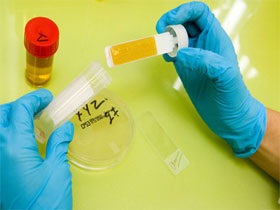 Infecția fungică a simptomelor, diagnosticului și tratamentului sistemului urinar