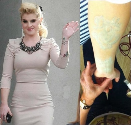 Kelly Osborne scapă de tatuaje