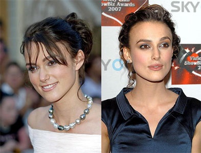 Kira Knightley chirurgie plastică - plastic - catalog de articole - corp plastic