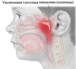 Crioterapia organelor ORL, centru medical 