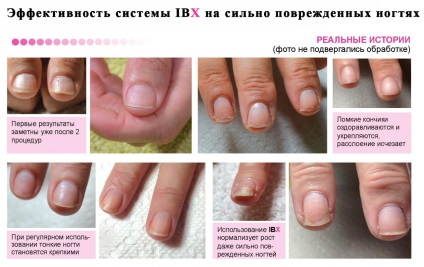 Tratamentul și întărirea unghiilor cu sistem ibx