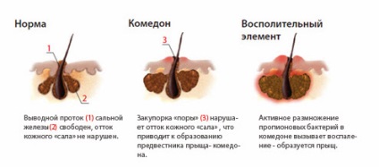 Mici cosuri pe fața cauzei, tratament, prevenire