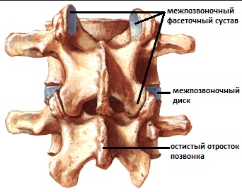 Chirurgie pentru scolioza