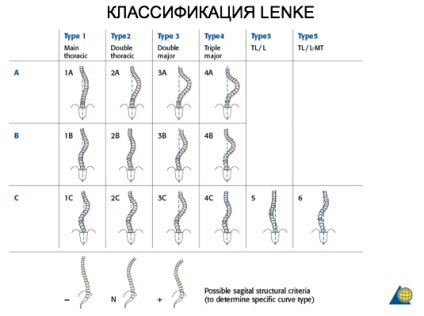 Chirurgie pentru scolioza