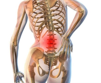 Osteochondroza părții lombare a cauzei, simptome, tratament