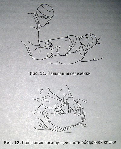 Palparea abdomenului, a stomacului, a intestinelor - site-ul ambulanței neoficiale al orașului Ekaterinburg