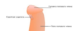 P - коротка вуздечка статевого члена