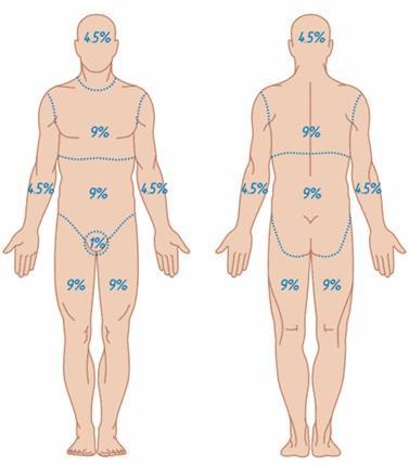 Szabály kilences és a tenyér területének meghatározására az égési sérülések
