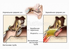 Produse pentru ameliorarea durerii artritei