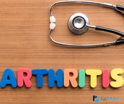 Termékek fájdalomcsillapítás arthritis