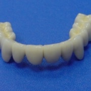 Protézisek a fémkerámia Dental Center „Pearl”