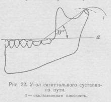 Miscari sagitale ale maxilarului inferior, stomatologie ortopedica