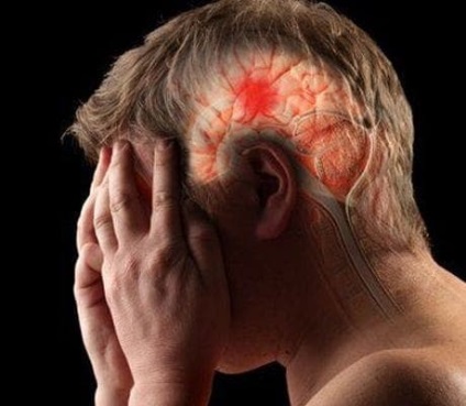 Starea de accident vascular cerebral despre care trebuie să știți