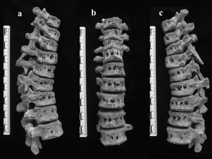 Tuberculoza oaselor - cauze, simptome, tratament