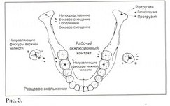 Efectul setărilor articulare articulare