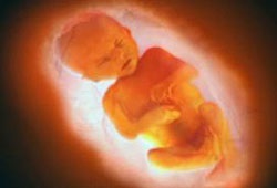37 hetes terhesség a baba - kész - a születés