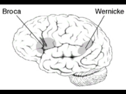 Afazia - simptome, cauze, tratament și diagnostic