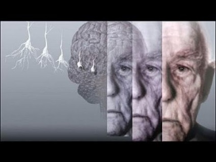 Ce este demența, simptomele, semnele și tratamentul?
