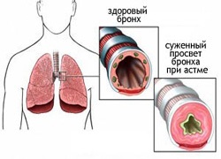 Diagnosticul și tratamentul cancerului