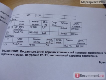 Electroneuromiografie (enmg) - 