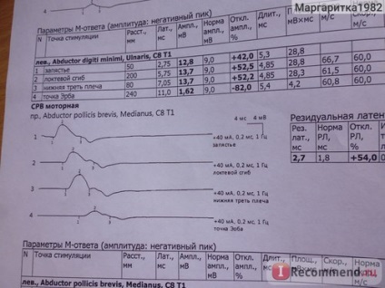 Electroneuromiografie (enmg) - 