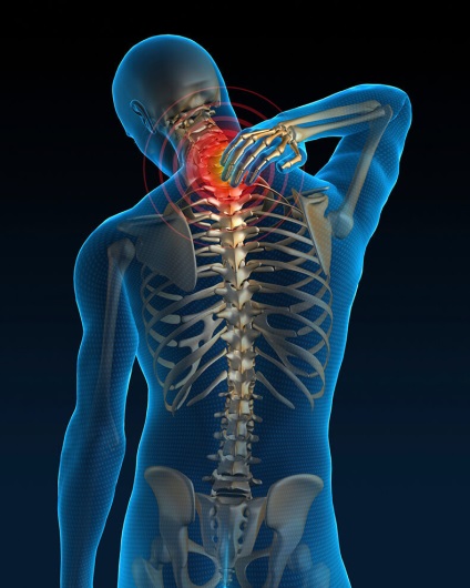 Acest lucru este important să știți! Principalele simptome ale osteocondrozei cervicale