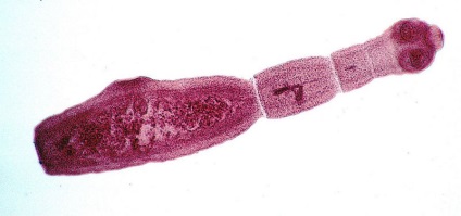 Ciclul Echinococcus de dezvoltare și structură