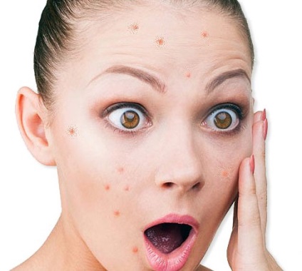 Cum sa curatati porii de acnee si acasa