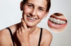 Cum să vă aliniați dinții acasă și să fixați mușcătura