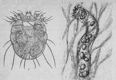 Cicatrice acariforme, paraziți ai corpului uman - ascaride, lamblia, viermi